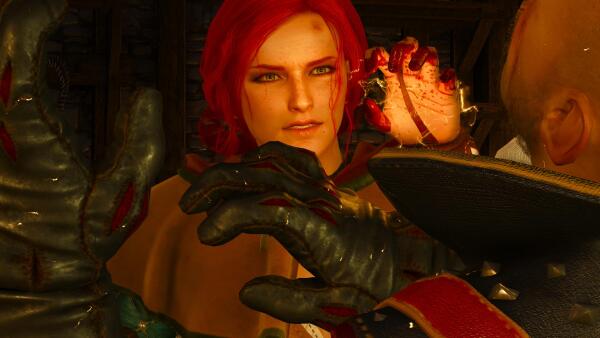 witcher3 Сорвали ногти.