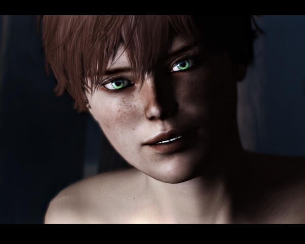 Freckles