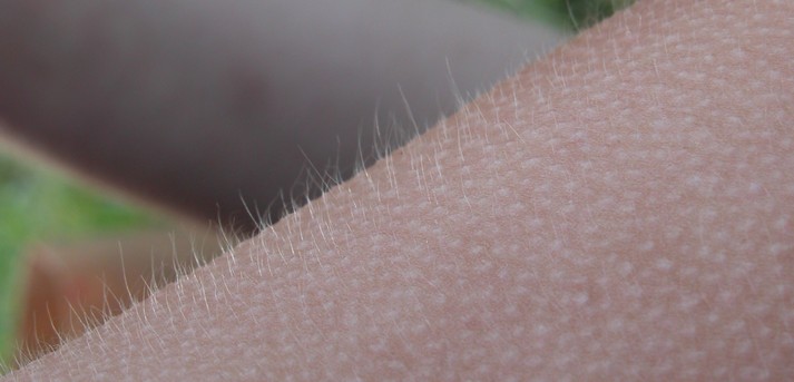 2003-09-17_Goose_bumps.jpg.jpeg