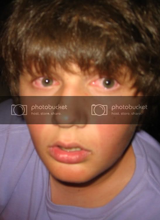 Marijuana_red_eyes.jpg.jpeg