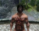 TYKZAR