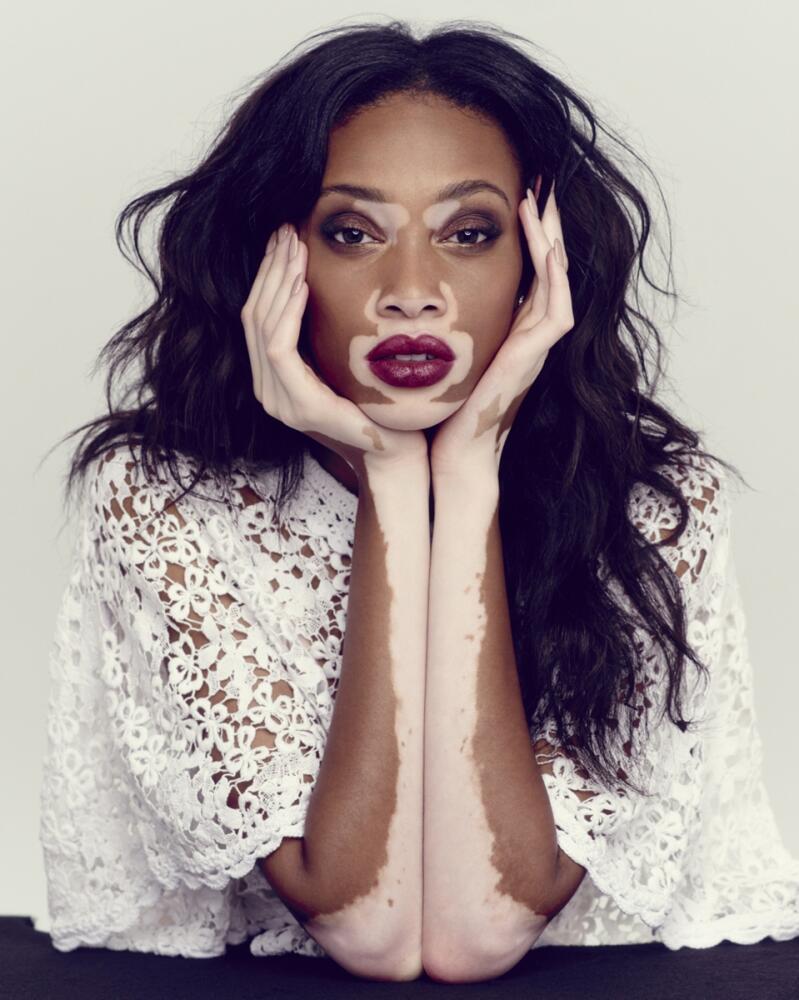 winnieharlow1.jpg.jpeg