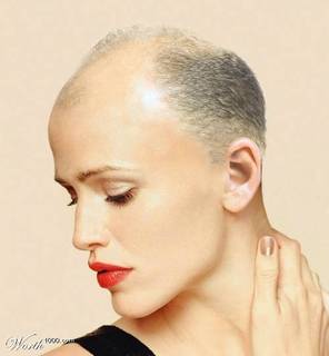 enxerto-de-cabelo-para-mulheres-5.jpg.jpeg