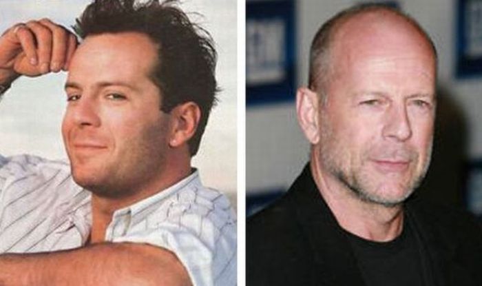 how_do_you_like_them_best_bald_or_with_07.jpg.jpeg
